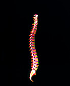 Coloured X-ray of a healthy human spine