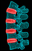 Computer artwork of the five lumbar vertebrae