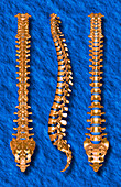 Computer artwork of three views of a human spine