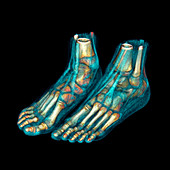 Feet,CT scan