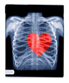 Love,composite X-ray