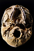 Base of human skull