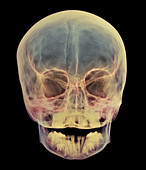Child's skull
