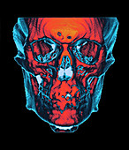 Skull,CT scan