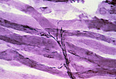 LM of human striated muscle fibres & nerves