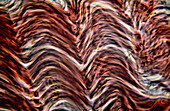 Light micrograph of smooth muscle tissue