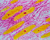 Colour TEM of smooth muscle from uterus wall