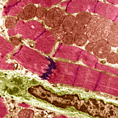 Cardiac muscle,TEM