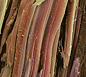 Tendon fibres,SEM