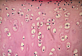 LM of hyaline cartilage that makes up the trachea