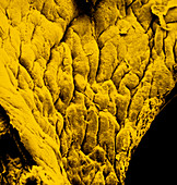 False-colour SEM of the knee's synovial membrane