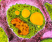 Coloured TEM of section through a chondrocyte cell