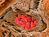 Coronary artery,SEM