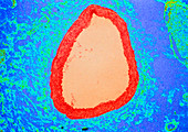 Coloured LM of a section through a coronary artery