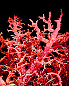 Blood vessels in a lung,SEM