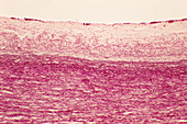 Aorta wall,light micrograph