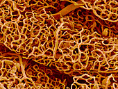 Blood vessels from the pancreas,SEM