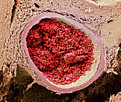 Blood-filled foetal aorta,SEM
