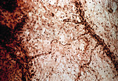 Mesenteric capillaries