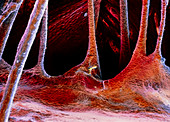 False-colour SEM of a portion of a cardiac valve