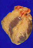 Gross specimen of a healthy human heart