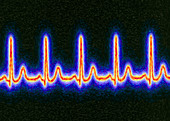 Computer artwork of healthy ECG trace of the heart