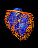 Computer simulation of a single heartbeat