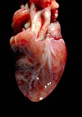 Foetal heart