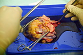 Heart being prepared for dissection