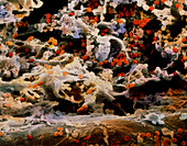 False-colour SEM of red cells in bone marrow