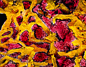 Coloured SEM of bone marrow in spongy bone