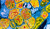 Coloured TEM of cells in bone marrow