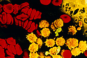 Coloured SEM of bone marrow cells