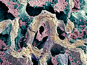 Bone marrow,SEM