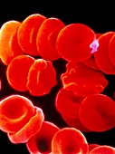 False-colour SEM of human red blood cells