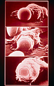 Sequence of SEMs: macrophage engulfing erythrocyte