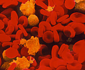 Red & white blood cells