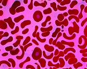 Coloured TEM of human red blood cells