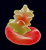 Red blood cell crenation,SEM