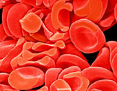 Red blood cells,SEM