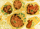 False-colour TEM of a group of human lymphocytes