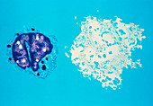 False-colour TEM of killer T-lymphocyte