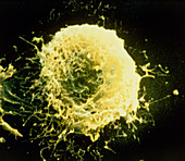False-colour SEM of a human granulocyte