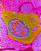False-colour TEM of a human plasmocyte