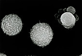 SEM of human white blood cell undergoing apoptosis