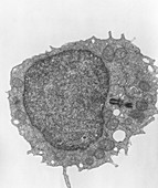 TEM of human lymphocyte blood cell