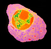 Coloured TEM of a plasma cell from bone marrow