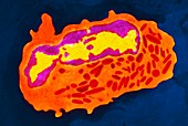 Coloured TEM of an eosinophil cell with crystals