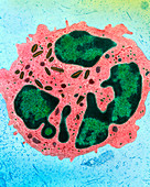 Coloured TEM of an eosinophil cell from the ovary