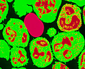 Coloured TEM of neutrophils (white blood cells)